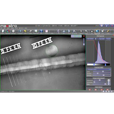 X射线数字图像获取及处理软件