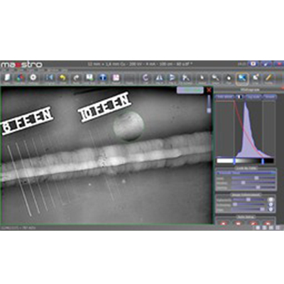 X射线数字图像获取及处理软件